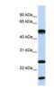 Ubiquitin Conjugating Enzyme E2 L6 antibody, NBP1-55036, Novus Biologicals, Western Blot image 