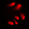CREB Binding Protein antibody, LS-B14818, Lifespan Biosciences, Immunofluorescence image 