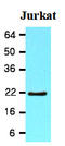 BH3 Interacting Domain Death Agonist antibody, AM09052PU-N, Origene, Western Blot image 