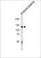 Complement C6 antibody, MBS9208912, MyBioSource, Western Blot image 