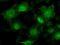 Signal Transducer And Activator Of Transcription 1 antibody, LS-C114639, Lifespan Biosciences, Immunofluorescence image 