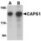 Calcium-dependent secretion activator 1 antibody, NBP1-77324, Novus Biologicals, Western Blot image 