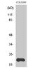 Mitochondrial Ribosomal Protein L40 antibody, A11512-1, Boster Biological Technology, Western Blot image 