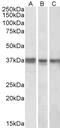 Bardet-Biedl Syndrome 4 antibody, 42-717, ProSci, Western Blot image 