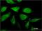 Ciliogenesis And Planar Polarity Effector 2 antibody, H00079363-M02, Novus Biologicals, Immunofluorescence image 
