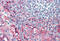 Intercellular Adhesion Molecule 1 antibody, MBS245394, MyBioSource, Immunohistochemistry frozen image 