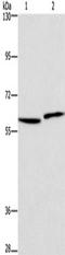 Hyaluronan Synthase 1 antibody, TA351240, Origene, Western Blot image 