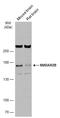 Glutamate Ionotropic Receptor NMDA Type Subunit 2B antibody, GTX133099, GeneTex, Western Blot image 