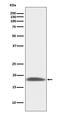 Lymphocyte antigen 6A-2/6E-1 antibody, M30403, Boster Biological Technology, Western Blot image 