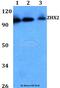 Zinc Fingers And Homeoboxes 2 antibody, A05837, Boster Biological Technology, Western Blot image 