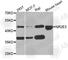 Nuclear Receptor Subfamily 2 Group E Member 3 antibody, A6234, ABclonal Technology, Western Blot image 