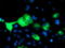 Proteasome 26S Subunit, Non-ATPase 2 antibody, TA503218, Origene, Immunofluorescence image 