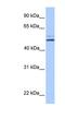 Mitochondrial sodium/hydrogen exchanger NHA2 antibody, NBP1-59579, Novus Biologicals, Western Blot image 