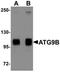 Autophagy Related 9B antibody, orb75437, Biorbyt, Western Blot image 