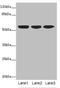 Keratin 10 antibody, A54994-100, Epigentek, Western Blot image 