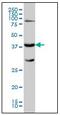 Galactose-1-phosphate uridylyltransferase antibody, AM31056PU-N, Origene, Western Blot image 