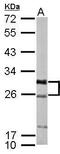 Potassium Voltage-Gated Channel Interacting Protein 1 antibody, PA5-30605, Invitrogen Antibodies, Western Blot image 