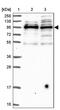 Spire Type Actin Nucleation Factor 1 antibody, PA5-59274, Invitrogen Antibodies, Western Blot image 