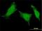 Mediator of RNA polymerase II transcription subunit 8 antibody, H00112950-M01, Novus Biologicals, Immunofluorescence image 