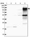 Phosphoinositide 3-kinase adapter protein 1 antibody, PA5-58397, Invitrogen Antibodies, Western Blot image 