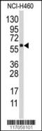 Cytochrome P450 Family 4 Subfamily F Member 12 antibody, 63-275, ProSci, Western Blot image 