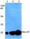 Homeobox protein Hox-1A antibody, PA5-36245, Invitrogen Antibodies, Western Blot image 