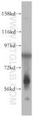 Ectonucleotide Pyrophosphatase/Phosphodiesterase 1 antibody, 14011-1-AP, Proteintech Group, Western Blot image 