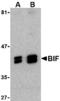 SH3 Domain Containing GRB2 Like, Endophilin B1 antibody, MBS150193, MyBioSource, Western Blot image 