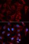Plakophilin-2 antibody, orb167411, Biorbyt, Immunofluorescence image 
