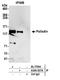 Palladin, Cytoskeletal Associated Protein antibody, A304-507A, Bethyl Labs, Immunoprecipitation image 