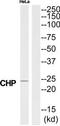 Cysteine And Histidine Rich Domain Containing 1 antibody, TA312339, Origene, Western Blot image 
