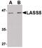 Ceramide Synthase 5 antibody, PA5-20570, Invitrogen Antibodies, Western Blot image 