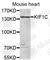 Kinesin Family Member 1C antibody, A5959, ABclonal Technology, Western Blot image 