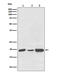 NADH:Ubiquinone Oxidoreductase Subunit B8 antibody, M07936-1, Boster Biological Technology, Western Blot image 