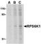 Ribosomal Protein S6 Kinase A1 antibody, TA306221, Origene, Western Blot image 