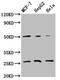 Mitochondrially Encoded Cytochrome C Oxidase II antibody, CSB-PA015073LA01HU, Cusabio, Western Blot image 
