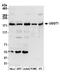 UDP-Glucose Glycoprotein Glucosyltransferase 1 antibody, A305-529A, Bethyl Labs, Western Blot image 