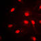 Transcription Factor AP-2 Alpha antibody, LS-C352913, Lifespan Biosciences, Immunofluorescence image 