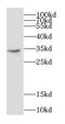 Capping Actin Protein Of Muscle Z-Line Subunit Alpha 1 antibody, FNab01255, FineTest, Western Blot image 