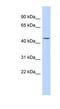 Keratin 24 antibody, NBP1-55188, Novus Biologicals, Western Blot image 