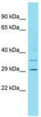 Chromosome 4 Open Reading Frame 50 antibody, TA334893, Origene, Western Blot image 