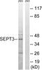 Neuronal-specific septin-3 antibody, A30742, Boster Biological Technology, Western Blot image 