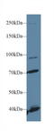 Fibroblast growth factor receptor 2 antibody, LS-C293915, Lifespan Biosciences, Western Blot image 
