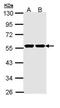 Glucokinase antibody, PA5-29325, Invitrogen Antibodies, Western Blot image 