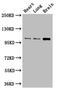 RNA Binding Motif Protein 10 antibody, A63294-100, Epigentek, Western Blot image 