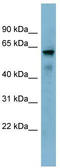 Methyltransferase Like 14 antibody, TA339744, Origene, Western Blot image 