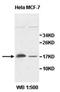 Zinc Finger Matrin-Type 4 antibody, orb77935, Biorbyt, Western Blot image 