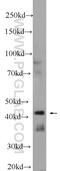 Migration And Invasion Inhibitory Protein antibody, 20630-1-AP, Proteintech Group, Western Blot image 