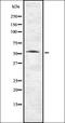 Transmembrane Serine Protease 2 antibody, orb336923, Biorbyt, Western Blot image 