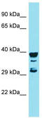 Regulator Of G Protein Signaling 7 Binding Protein antibody, TA334912, Origene, Western Blot image 